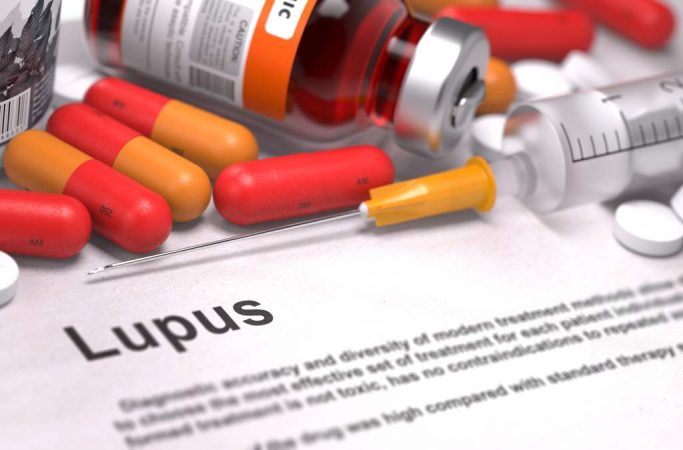 Inilah Daftar Obat yang Efektif untuk Pengelolaan Lupus